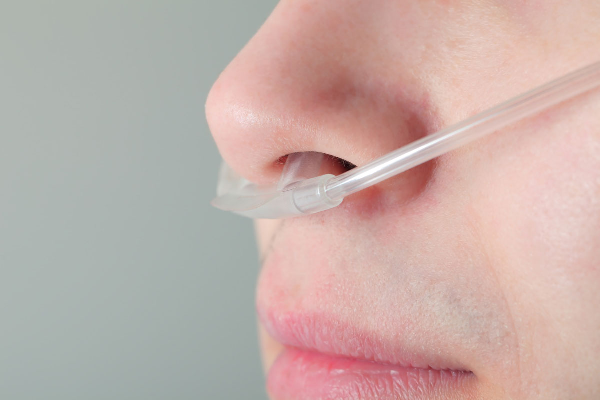 A close-up view of a patient's nose with a clear oxygen tube inserted.